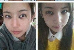 韩国整容医生爆料视频,揭秘整形手术背后的真相