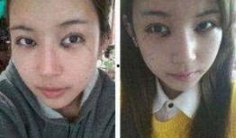 韩国整容医生爆料视频,揭秘整形手术背后的真相